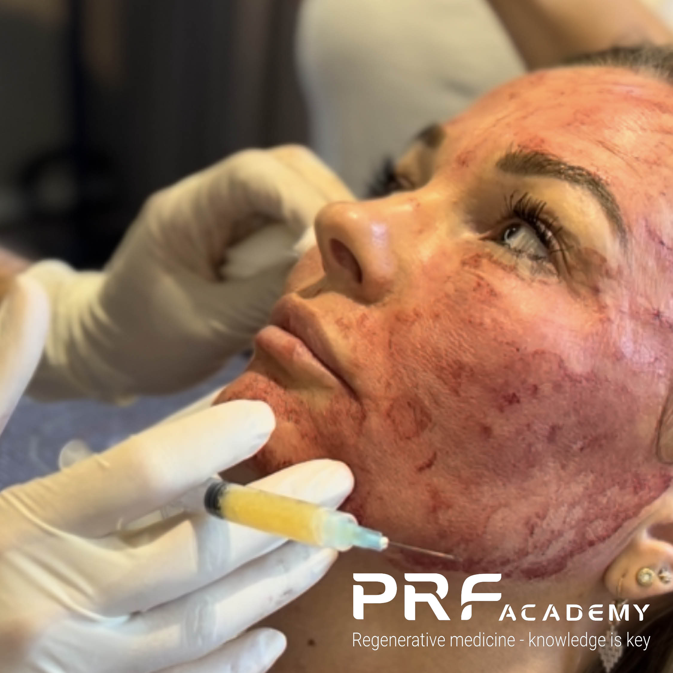 Puredent (Lumoral), picture 3